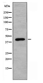 ACOT1 Antibody