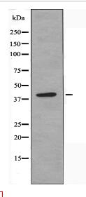 ALDOB Antibody