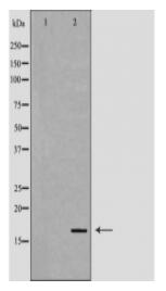 FHIT Antibody