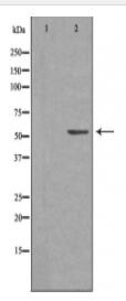 CARKL Antibody