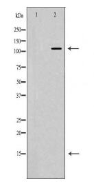 AR Antibody