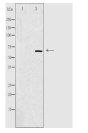 CCT5 Antibody