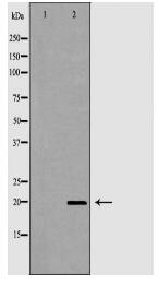 CD69 Antibody