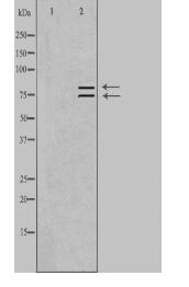 ARHGEF7 Antibody