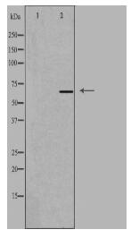 CFI Antibody