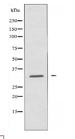 CBR1 Antibody