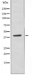 ARFIP1 Antibody