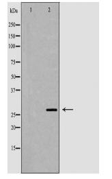 ADIPOQ Antibody