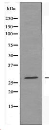 ANP32B Antibody