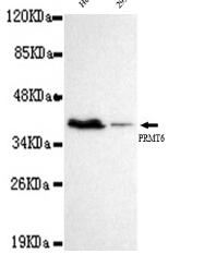 PRMT6 Mouse mAb