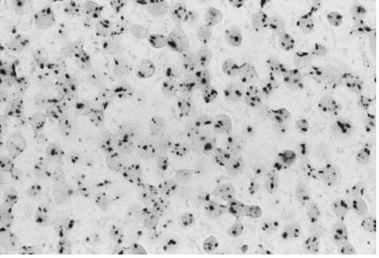 CARD-Nanogold detection of Sinlge-Copy HPV-16 in SiHa cells (59k)