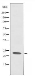 DNAL1 Antibody