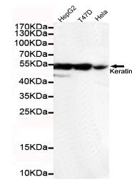 Keratin 7(C-term) Mouse mAb