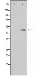 AGBL4 Antibody