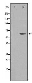 ADRB2 Antibody