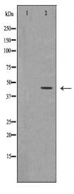 CHI3L1 Antibody