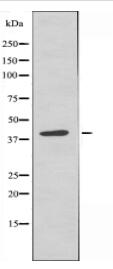 B4GALT5 Antibody