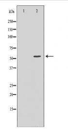 ACVR2A Antibody