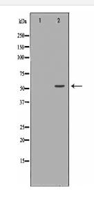 AKT2 Antibody