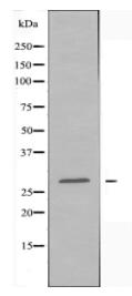BRMS1 Antibody
