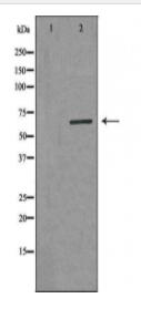 ARSI Antibody