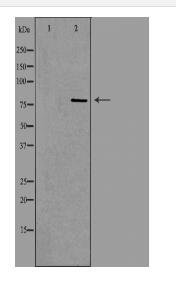 ADARB1 Antibody
