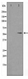 FOXC1/2 Antibody