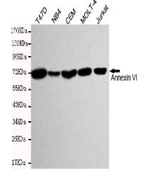 Annexin VI Mouse mAb
