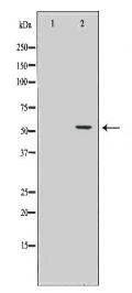 ALDH1A1 Antibody