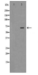 DDX5 Antibody
