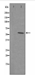 AIRE Antibody
