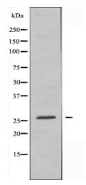 ATP5H Antibody