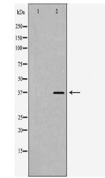 CD1D Antibody