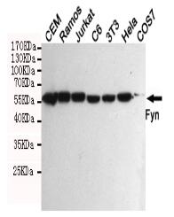 Fyn Mouse mAb