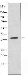 CCRL1 Antibody