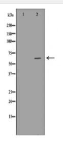 ASNS Antibody