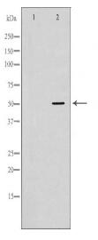 CFP Antibody
