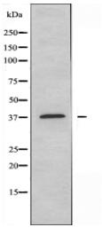CA5B Antibody