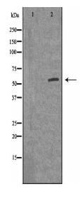 ACV1B Antibody