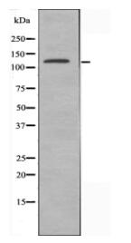 BUB1B Antibody