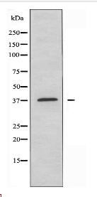 ABHD9 Antibody