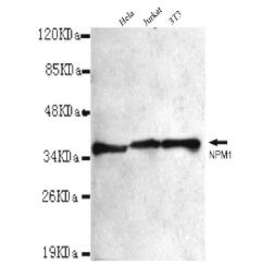 NPM1 Mouse mAb