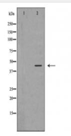 ATXN3 Antibody
