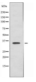 BNIP2 Antibody