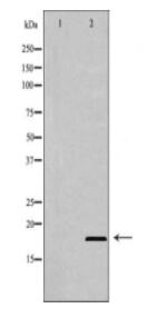 BIK Antibody