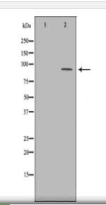 BCL11A Antibody