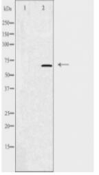 GRK5 Antibody