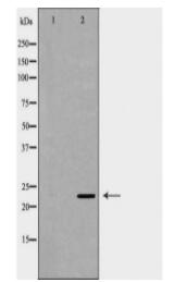 GNA11 Antibody