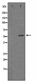 ARSA Antibody