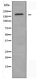 ARHGEF11 Antibody